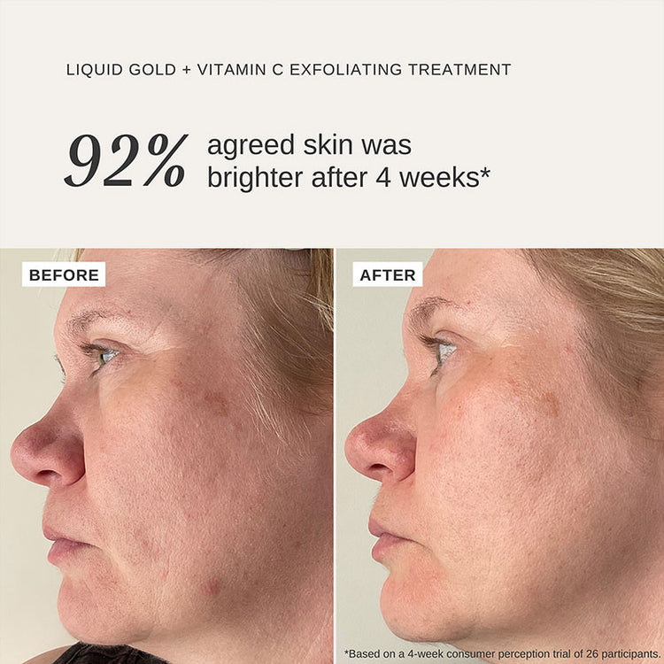 Alpha-H Liquid Gold + Vitamin C 100ml