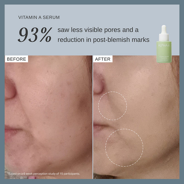 Alpha-H Vitamin A Serum with 0.3% Retinol + 1% Bio-Retinol 25ml