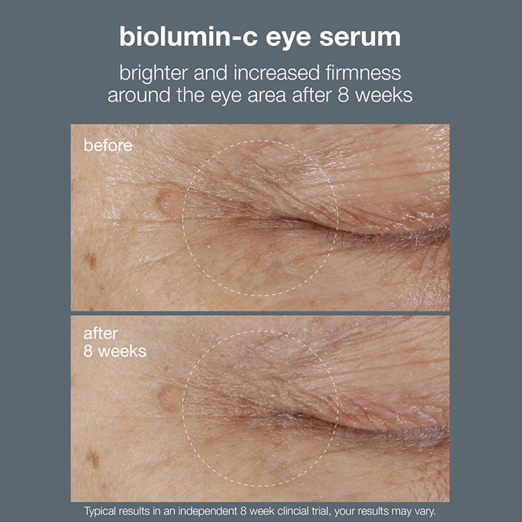 Dermalogica Biolumin-C Eye Serum 15ml