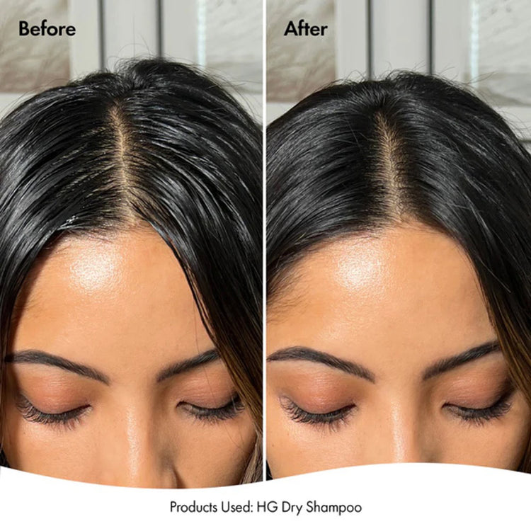 BondiBoost Hair Growth Dry Shampoo 200ml