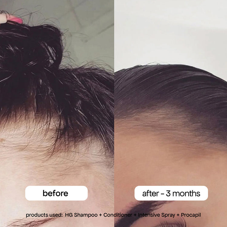 BondiBoost Intensive Scalp Spray 125ml