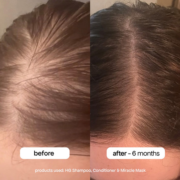 BondiBoost Miracle Hair Mask 250ml