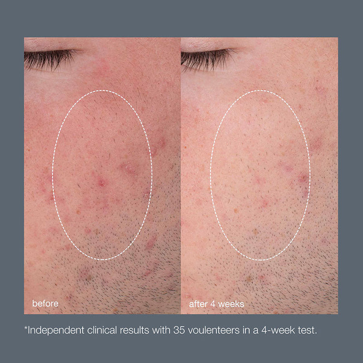 Dermalogica Daily Microfoliant (Travel Size) 13g