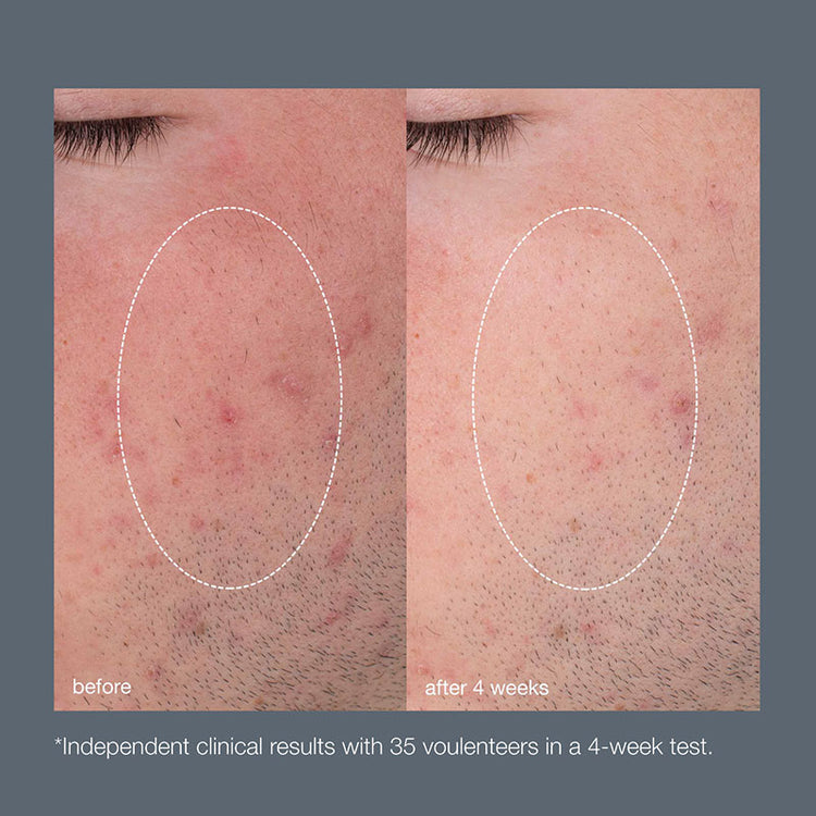 Dermalogica Daily Microfoliant Refill 74g