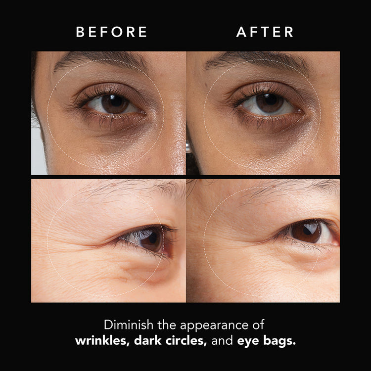 FOREO FAQ Microneedling Anti-Wrinkle Hyaluronic Acid Patches For Under Eyes (3 Pairs)