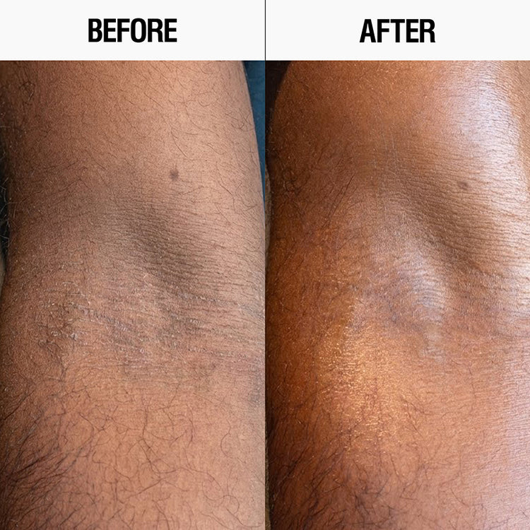 Grown Alchemist Resurfacing Targeted Body Lotion 300ml