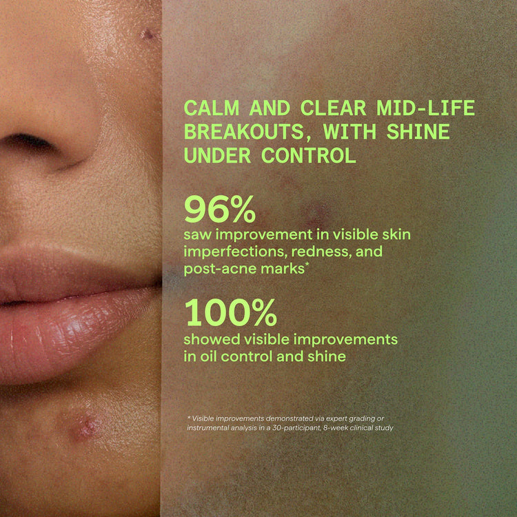 Murad Biome Balancing Calm & Recover Cream 50ml