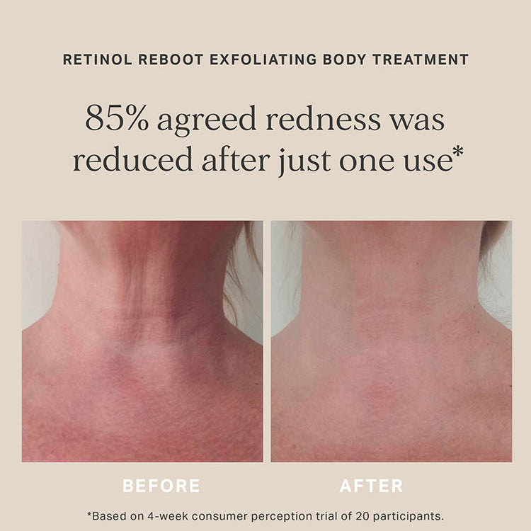 Alpha-H Retinol Reboot Exfoliating Body Treatment 120ml