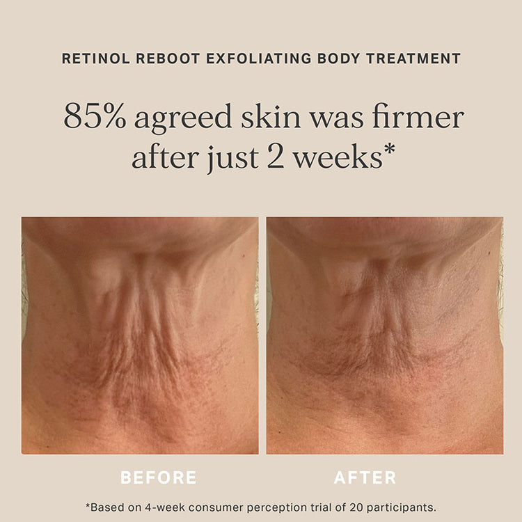 Alpha-H Retinol Reboot Exfoliating Body Treatment 120ml