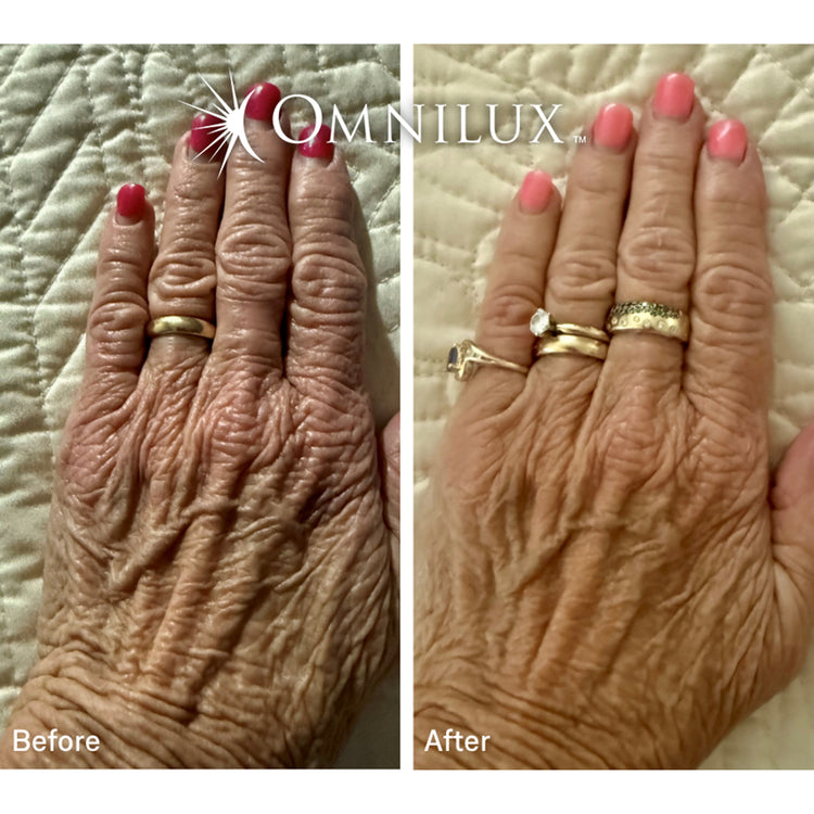 Omnilux Contour Glove Duo