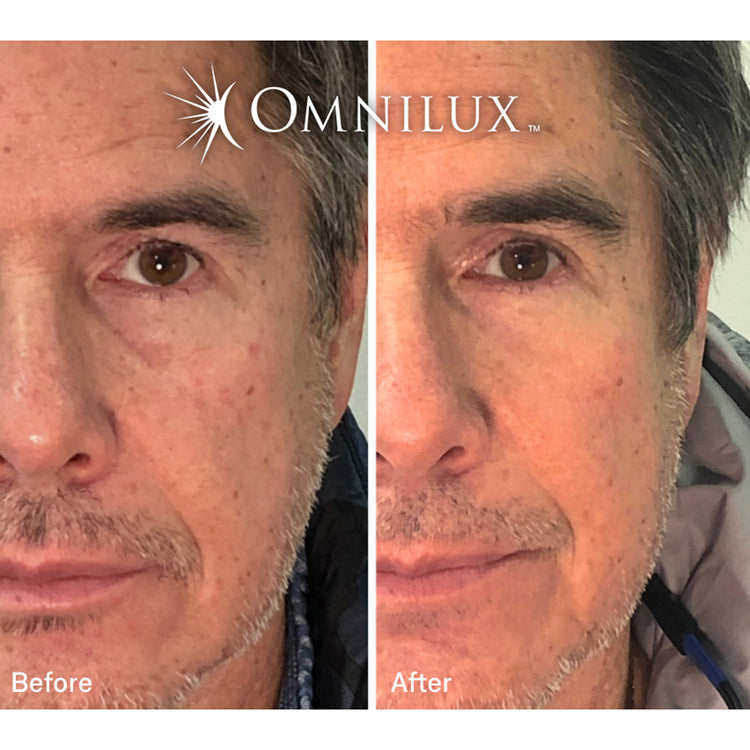 Omnilux Contour Men