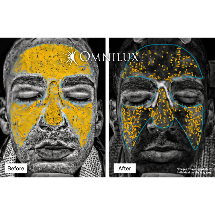 Omnilux Contour Men