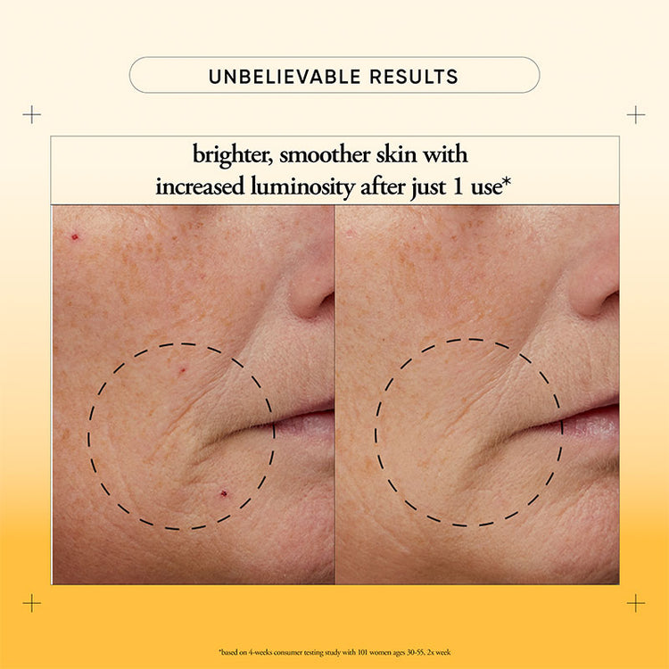 Philosophy Microdelivery Mini Resurfacing Peel Kit 30ml + 30g