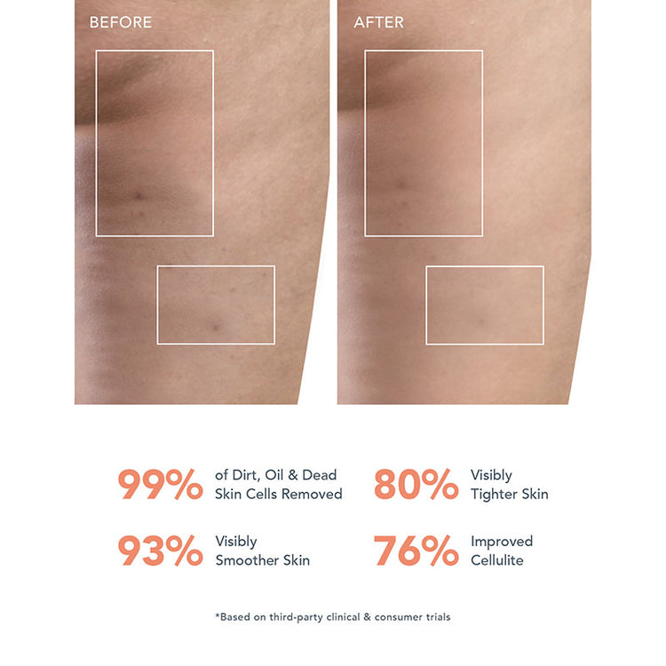 FOREO Luna 4 Body Cleansing Routine - Peach Perfect