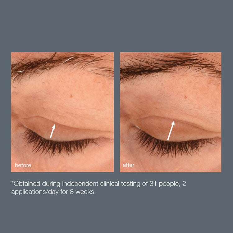 Dermalogica Phyto Nature Lifting Eye Cream 15ml