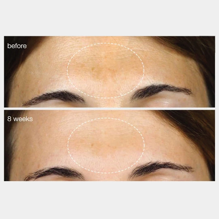 Dermalogica PowerBright Dark Spot Serum 30ml