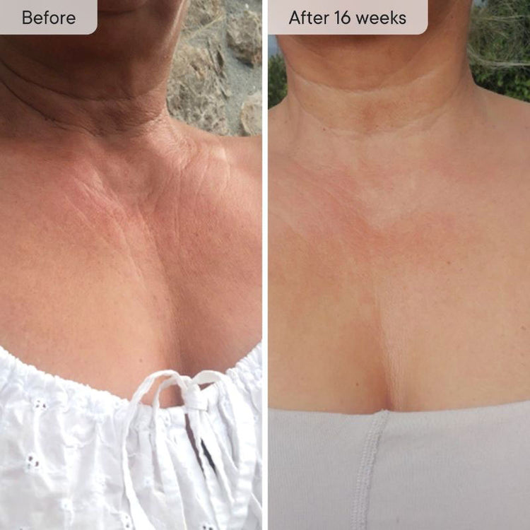 Qure Skincare Neck & Decolletage LED System