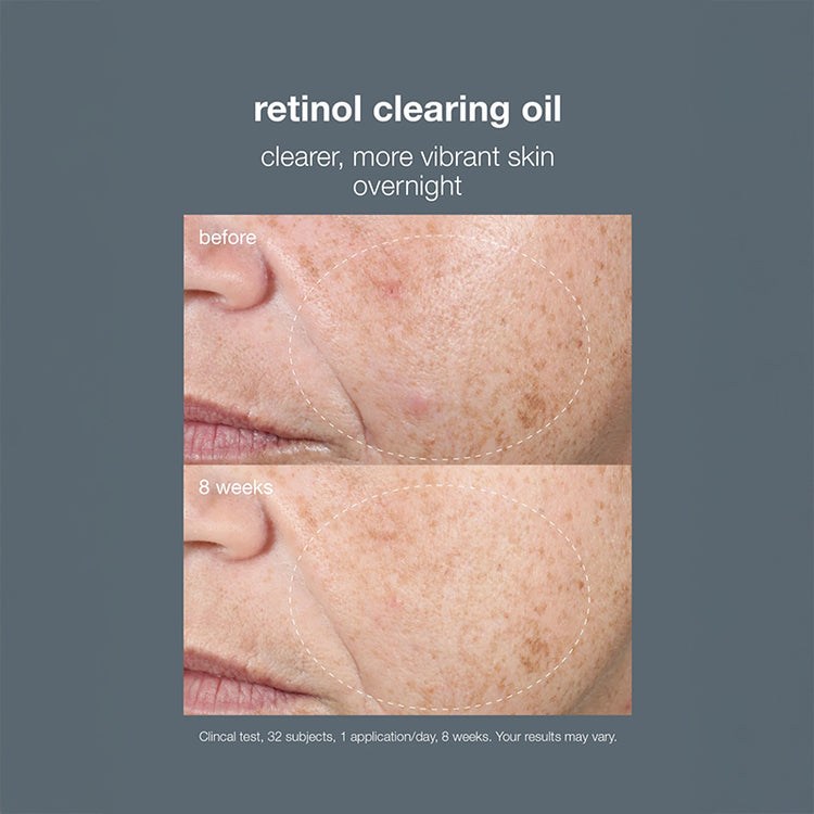 Dermalogica Retinol Clearing Oil 30ml