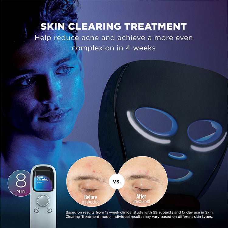 Shark CryoGlow™ Cooling + LED Face Mask - Blue Frost