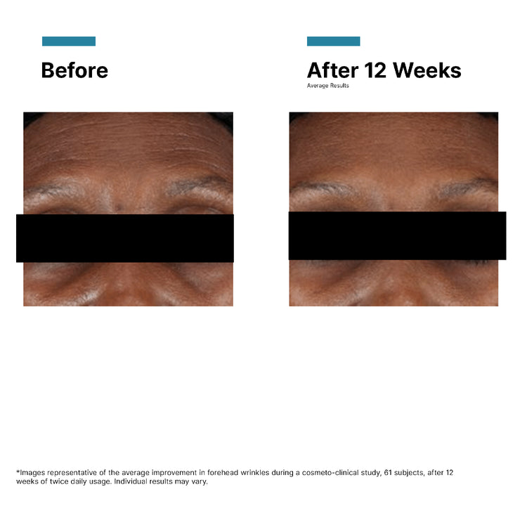SkinCeuticals A.G.E. Interrupter Advanced 48ml