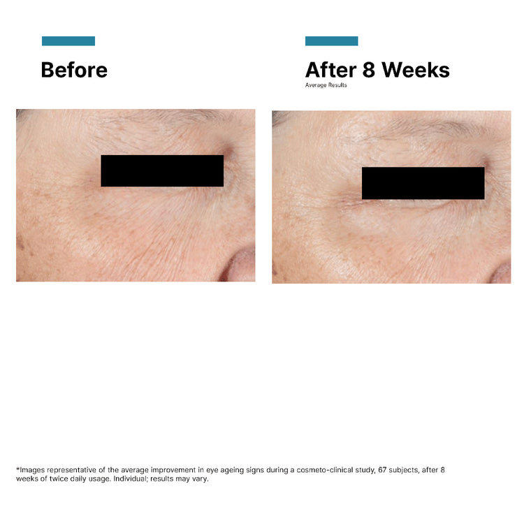 SkinCeuticals A.G.E. Advanced Eye 15ml