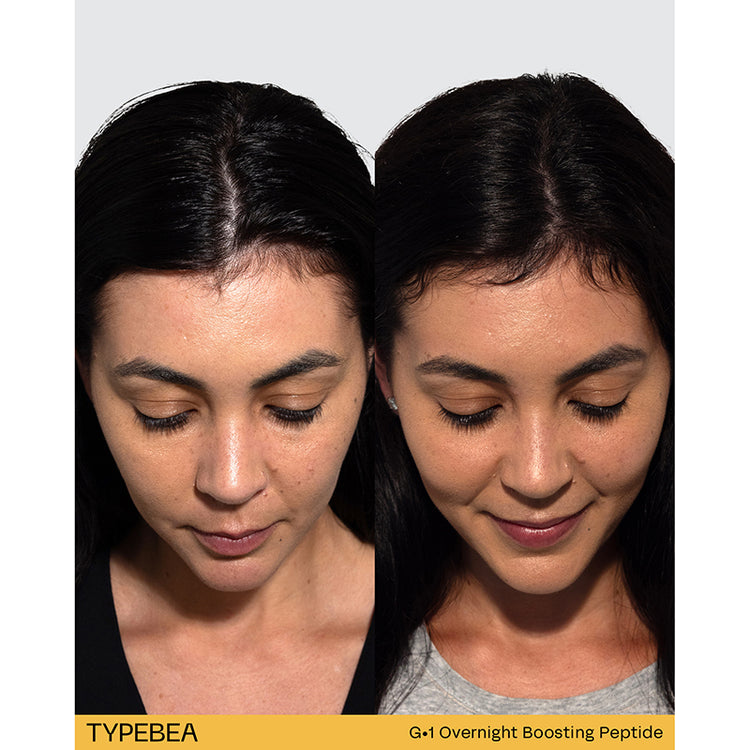 TYPEBEA G1 Overnight Boosting Peptide Serum 100ml