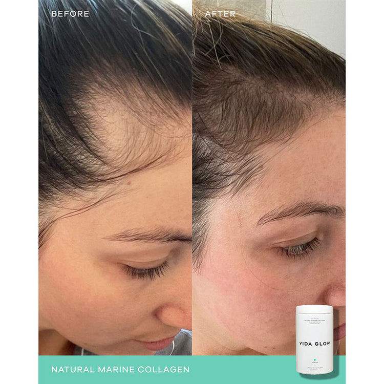 Vida Glow Natural Marine Collagen Loose Powder 270g (90 serves)