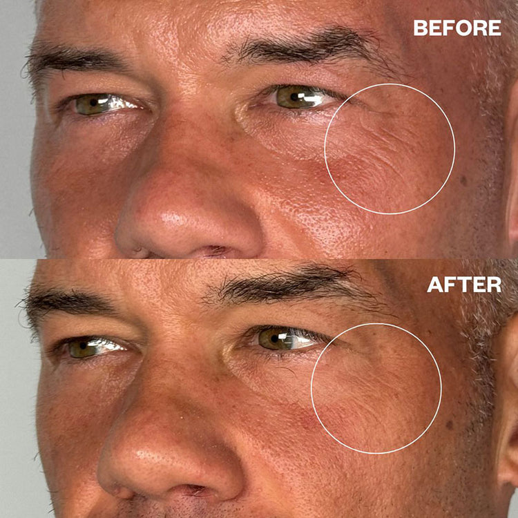 Wrinkles Schminkles Men's Pro Eye Wrinkles Patches - 1 Pair