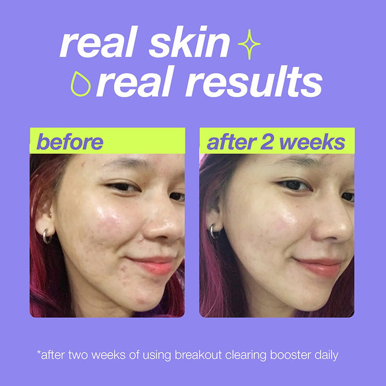 Dermalogica Clear Start Breakout Clearing Booster 30ml