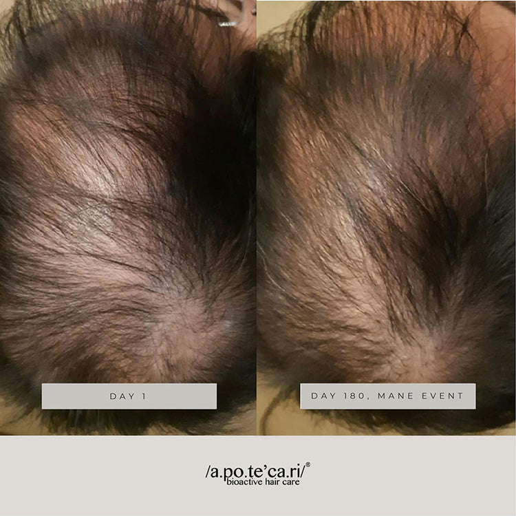 Apotecari Mane Event 90 Day Kit