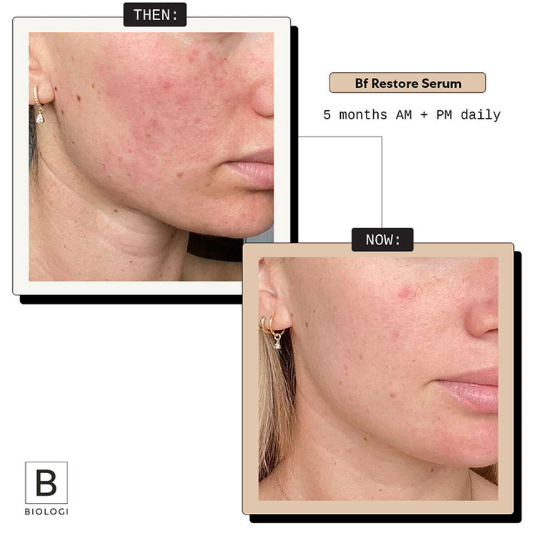 Biologi Bf Restore Face & Body Serum 20ml