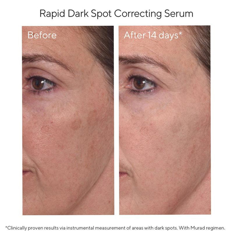 Murad Rapid Dark Spot Correcting Serum 30ml