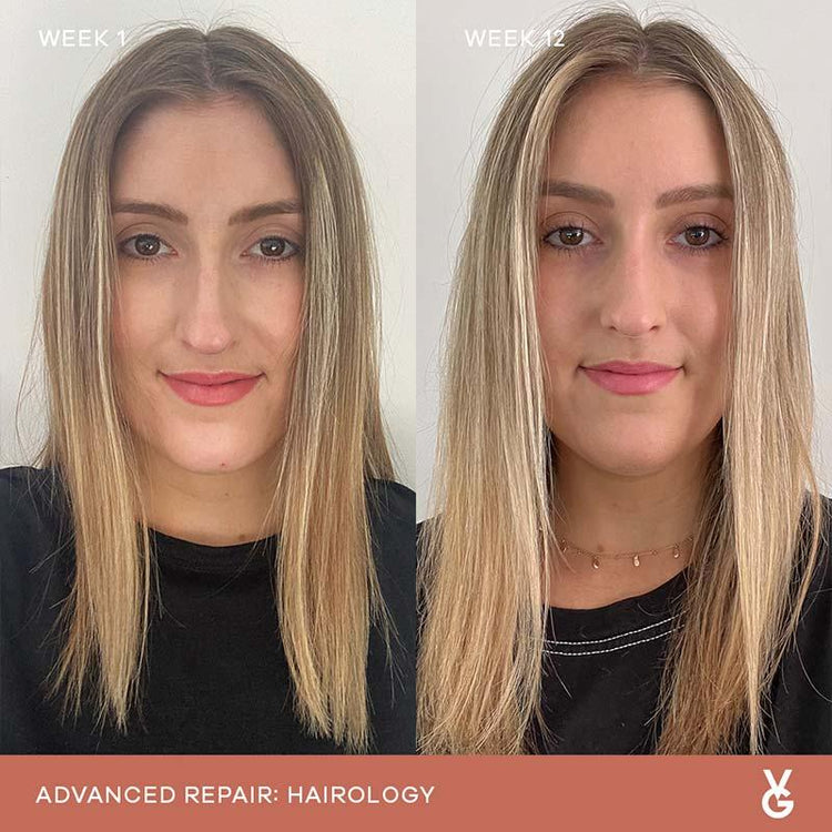 Vida Glow Advanced Repair Hairology (30 Capsules)