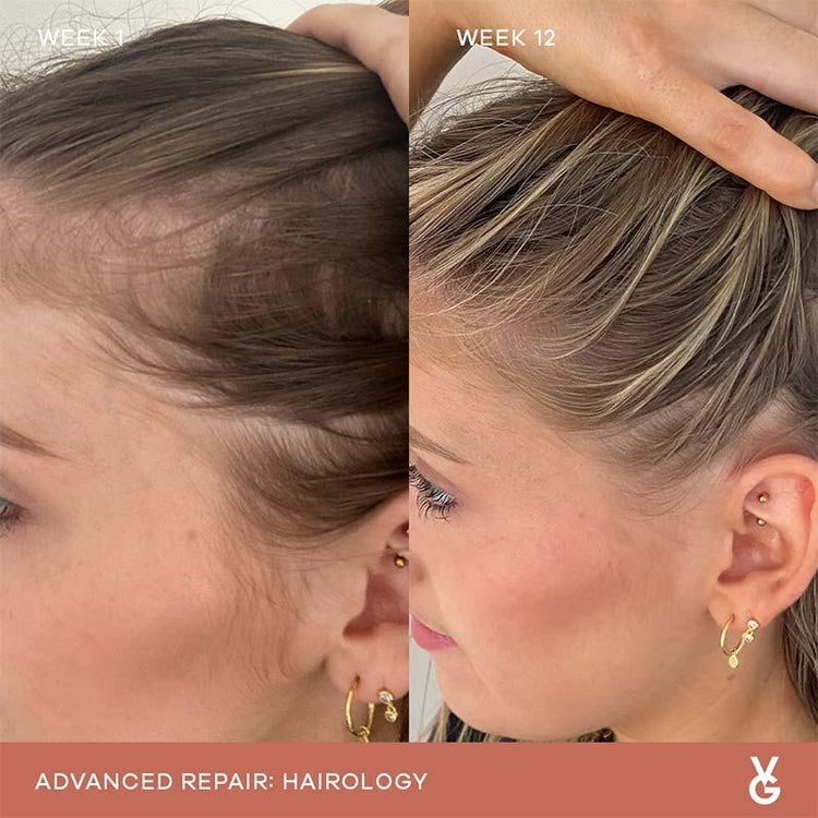 Vida Glow Advanced Repair Hairology (30 Capsules)