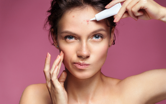 The 12 Best Products for Hormonal Acne