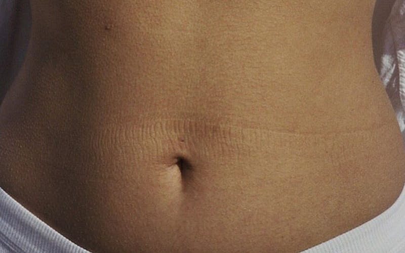 5 Ways The Gut Microbiome Influences Our Health