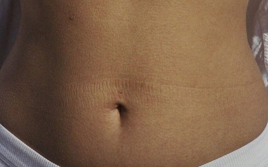 5 Ways The Gut Microbiome Influences Our Health