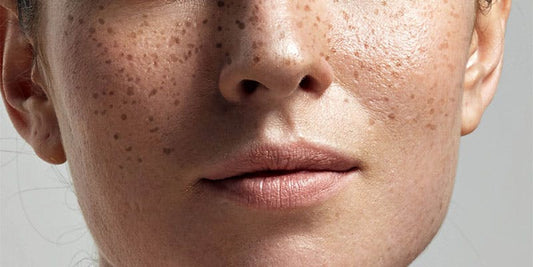 The Best Overnight Treatments Your Skin is Missing