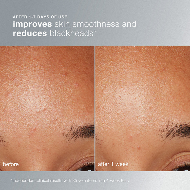 Dermalogica Daily Microfoliant 74g