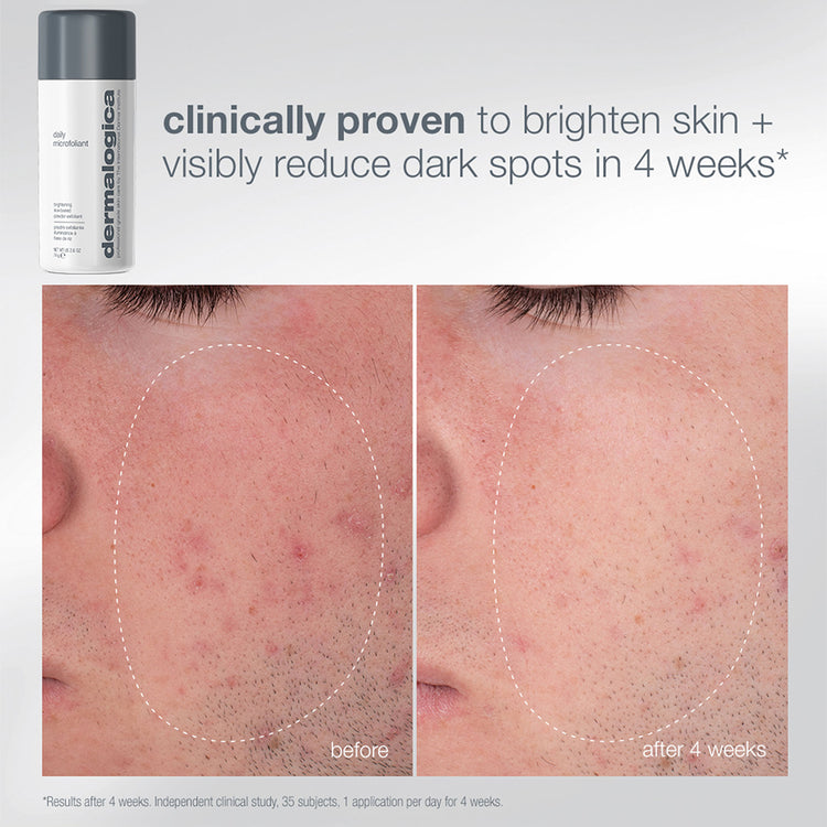 Dermalogica Expert Cleanse + Glow Set