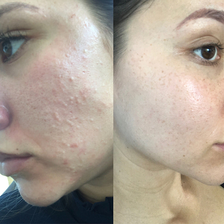 Biologi Bd Luminosity Face Serum 30ml