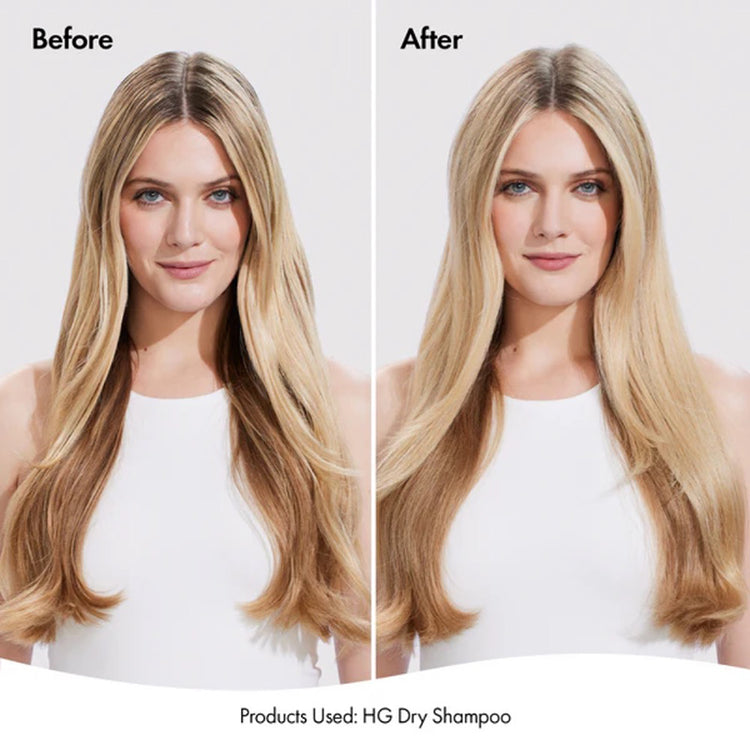 BondiBoost Hair Growth Dry Shampoo 200ml