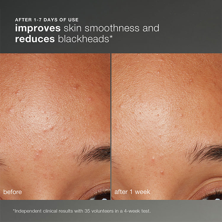 Dermalogica Daily Microfoliant 74g