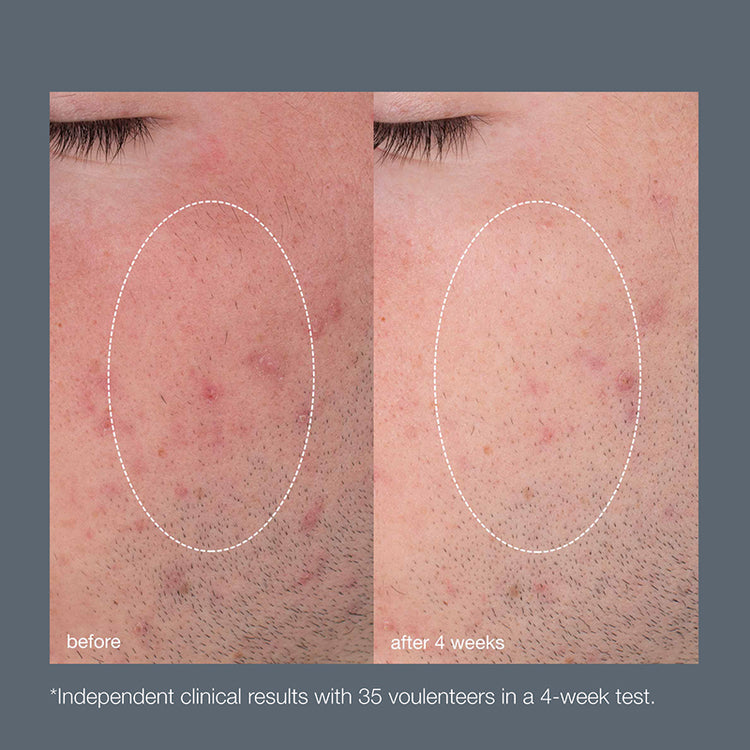 Dermalogica Daily Microfoliant Full size + Refill Pouch