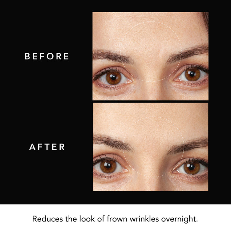 FOREO FAQ Microneedling Anti-Wrinkle Hyaluronic Acid Patches For Forehead (3 Patches)