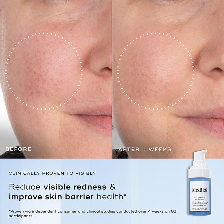 Medik8 Niacinamide Peptides 30ml