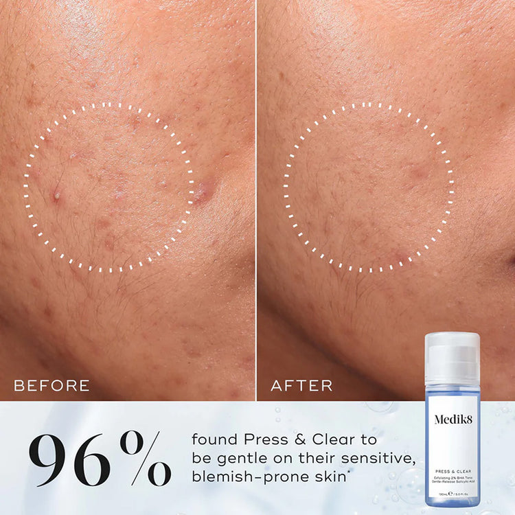 Medik8 Press & Clear 150ml