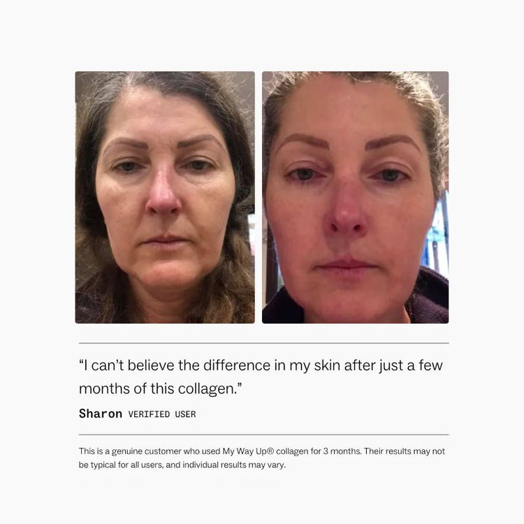 My Way Up Collagen Restore 270g