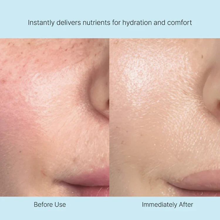 Rejuran Healer Nutritive Cream 50ml