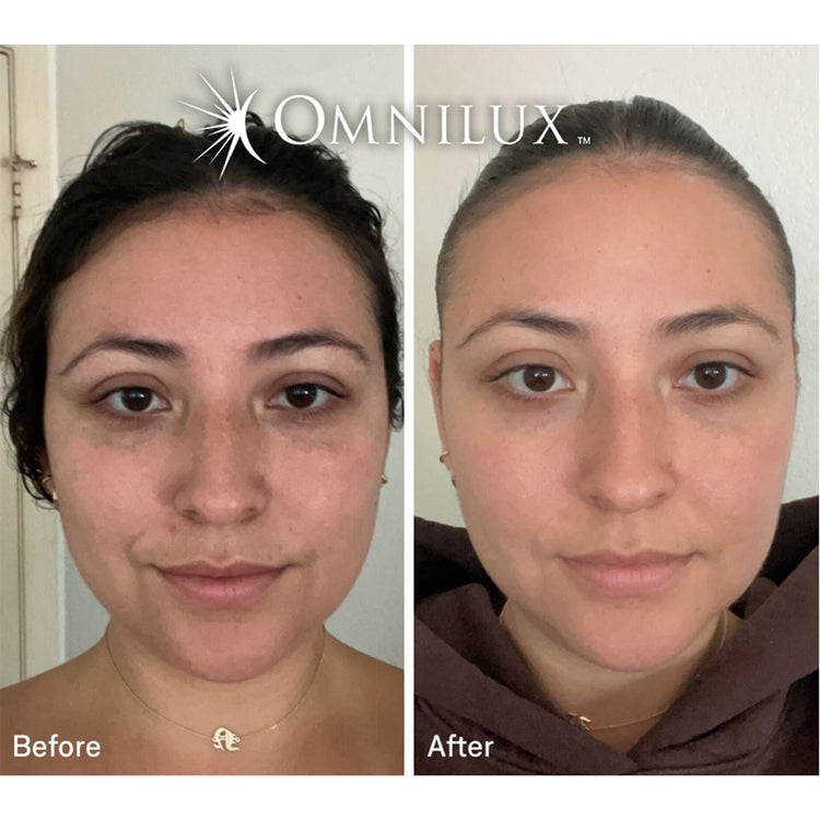 Omnilux Contour Face
